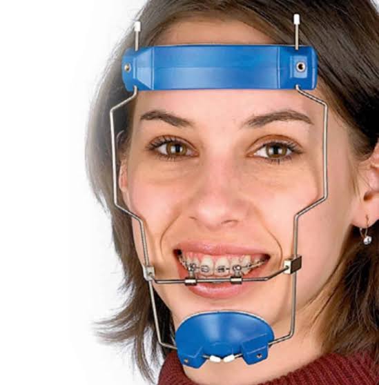 dental-head-gear-v0-kub2xoqbgedc1