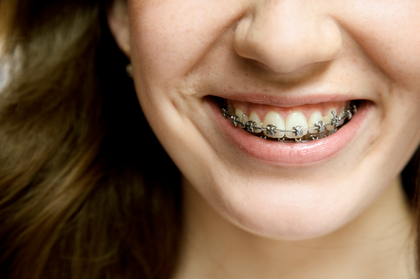 iStock_000013269395_Small